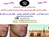 المركز التركى لزراعة الشعر والذقن
