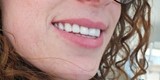 DentCenterTurkey اخصائيون تجميل اسنان في تركيا