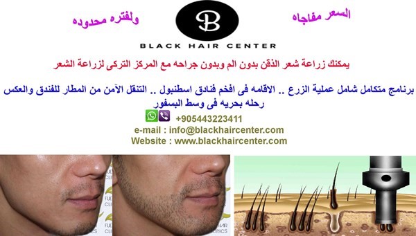 المركز التركى لزراعة الشعر والذقن