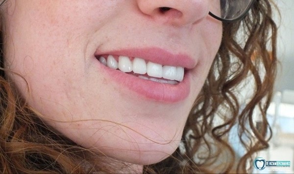 DentCenterTurkey اخصائيون تجميل اسنان في تركيا