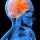 عيادة المخ والاعصاب والعمود الفقرى